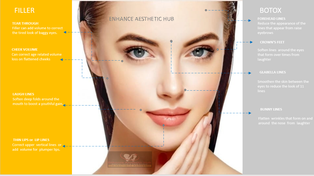 Injectables